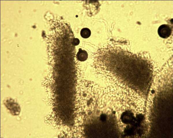 Steccherinum ochraceum ? (Steccherinum ochraceum)